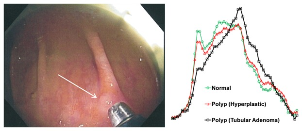 Raman Spectroscopy and Endomicroscopy Imaging 1