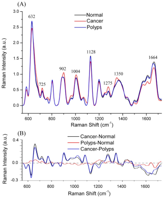 Raman Spectroscopy and Endomicroscopy Imaging 3