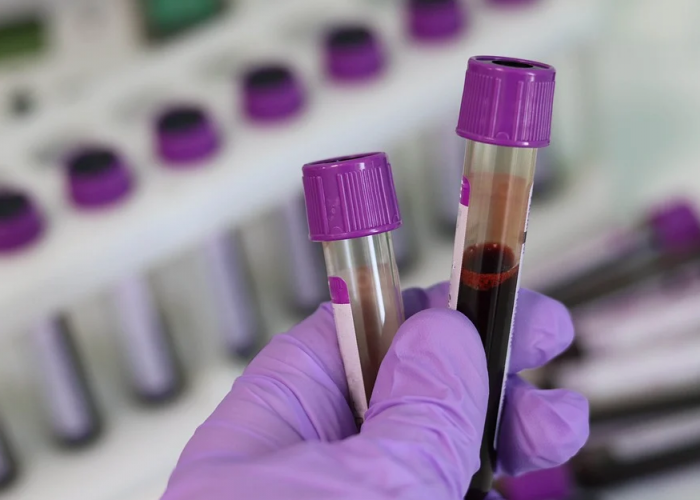 BBRS purple blood tubes