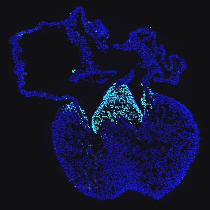 Fluorescent microscope image of a histological section of the embryonic heart valve, day 12.5