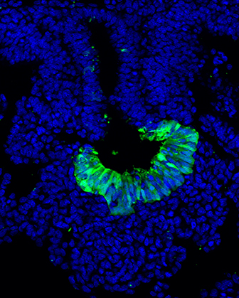 Histological section showing liver formation. Epithelial bud is highlighted by the expression of green fluorescent protein. Cell nuclei are shown in blue (dapi)